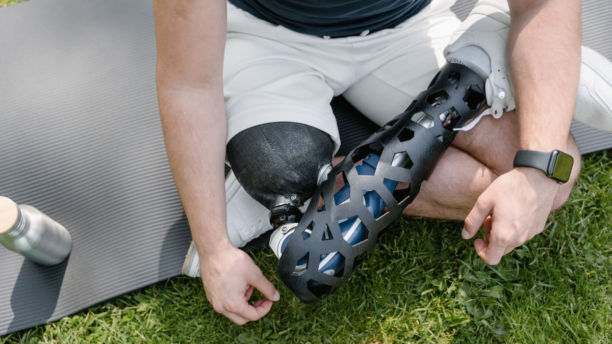 Close-up of a person with a prosthetic leg sitting on grass with exercise mat, embracing a healthy lifestyle.