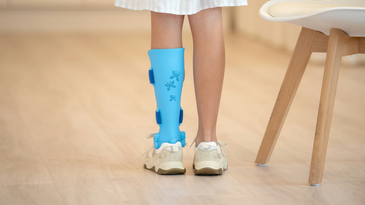 a person with a broken leg wearing a pair of blue boots